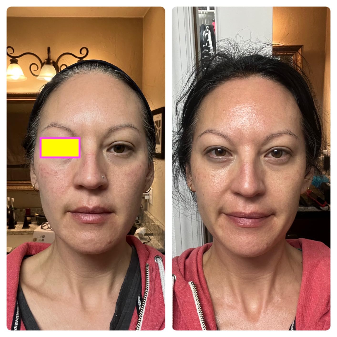 TheraFace Therabody TheraFace PRO - Microcurrent Facial Device, 8-in-1 Compact Face Massager & Facial Sculpting Tool with Light Therapy for Skin Tightening, Anti Wrinkle, Anti Aging & Skin Care (White) customer photo 1
