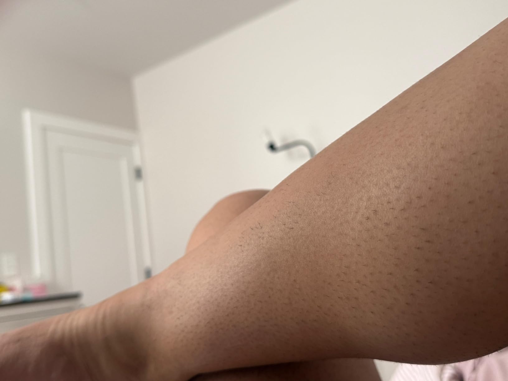 Philips Lumea IPL, Salon-Like Laser Hair Removal for Women, Permanent Hair Reduction Device At Home for Face & Body, Safe & Painless for Face, Bikini, Body, 5 Settings & Skin Sensors, BRI984/03 customer photo 1