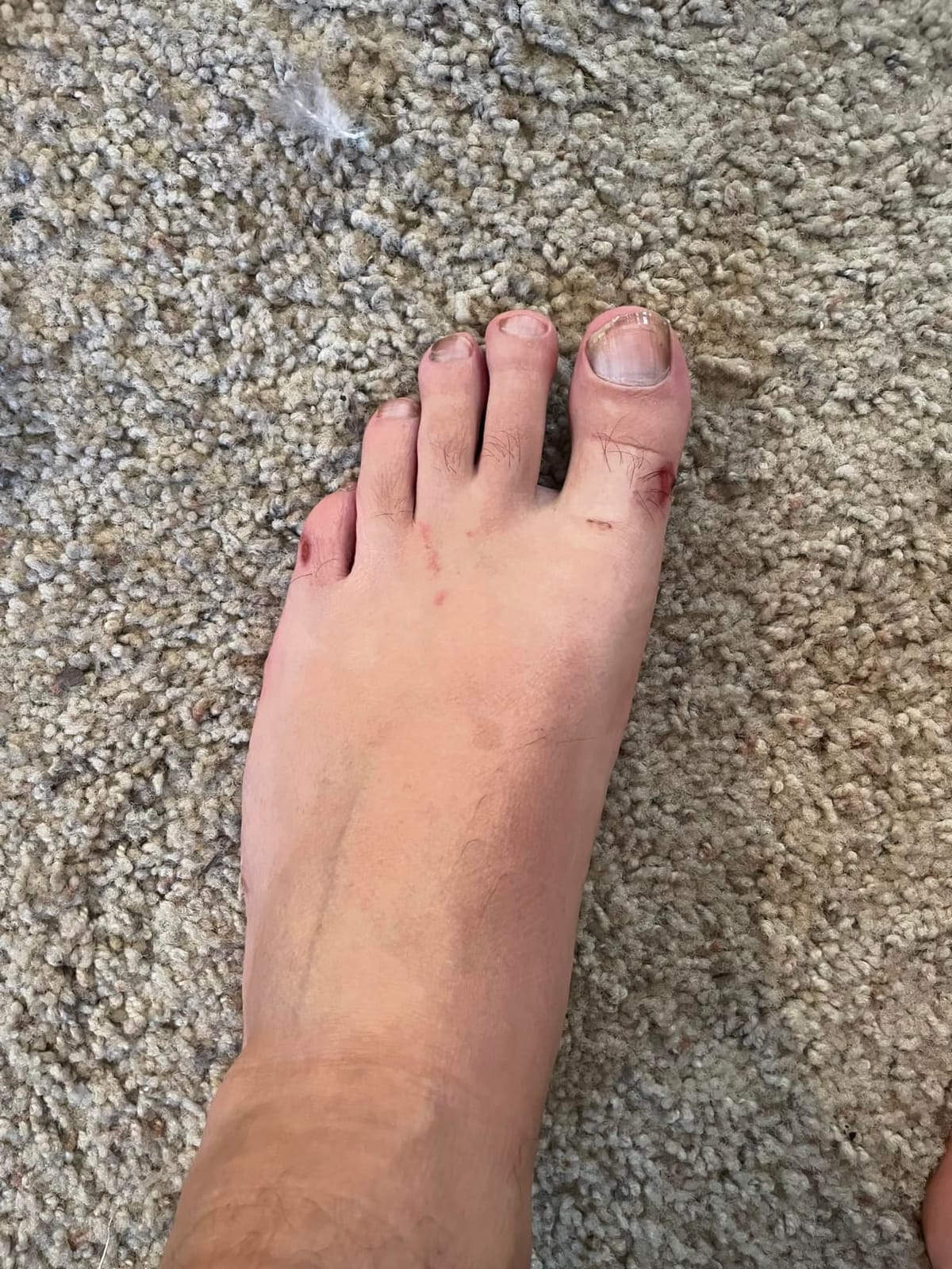 Chaco Men's Zcloud Athletic Sandal customer photo 1