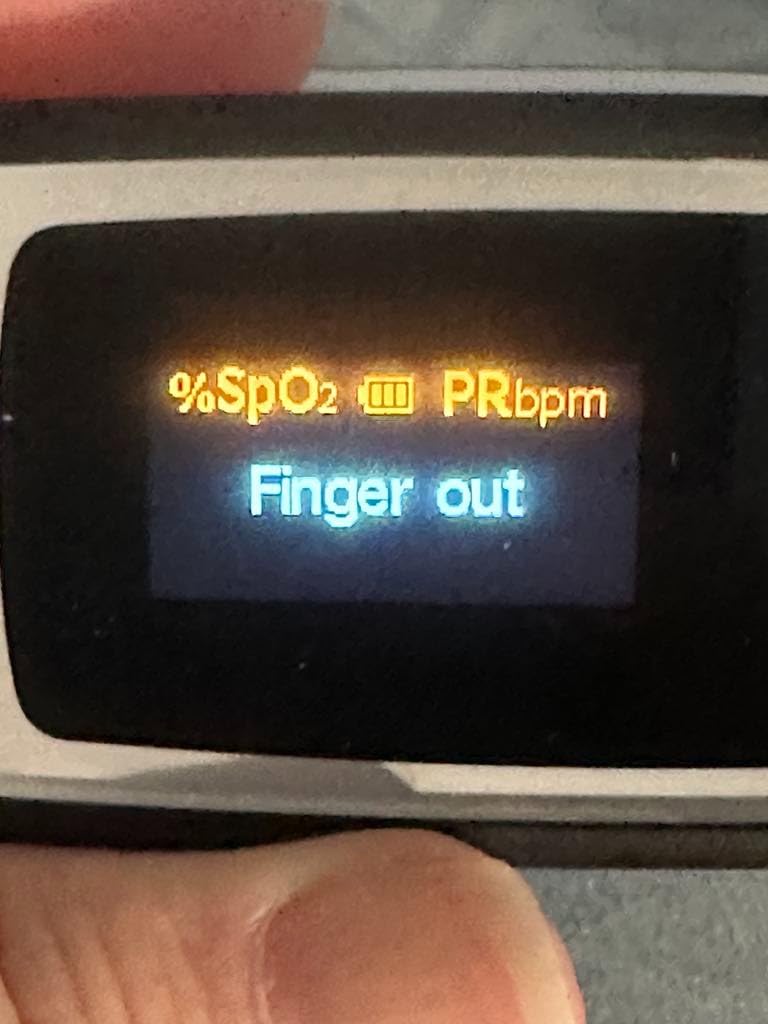 Innovo Deluxe iP900AP Fingertip Pulse Oximeter Blood Oxygen Saturation Monitor with Alarm, Plethysmograph and Perfusion Index customer photo 1
