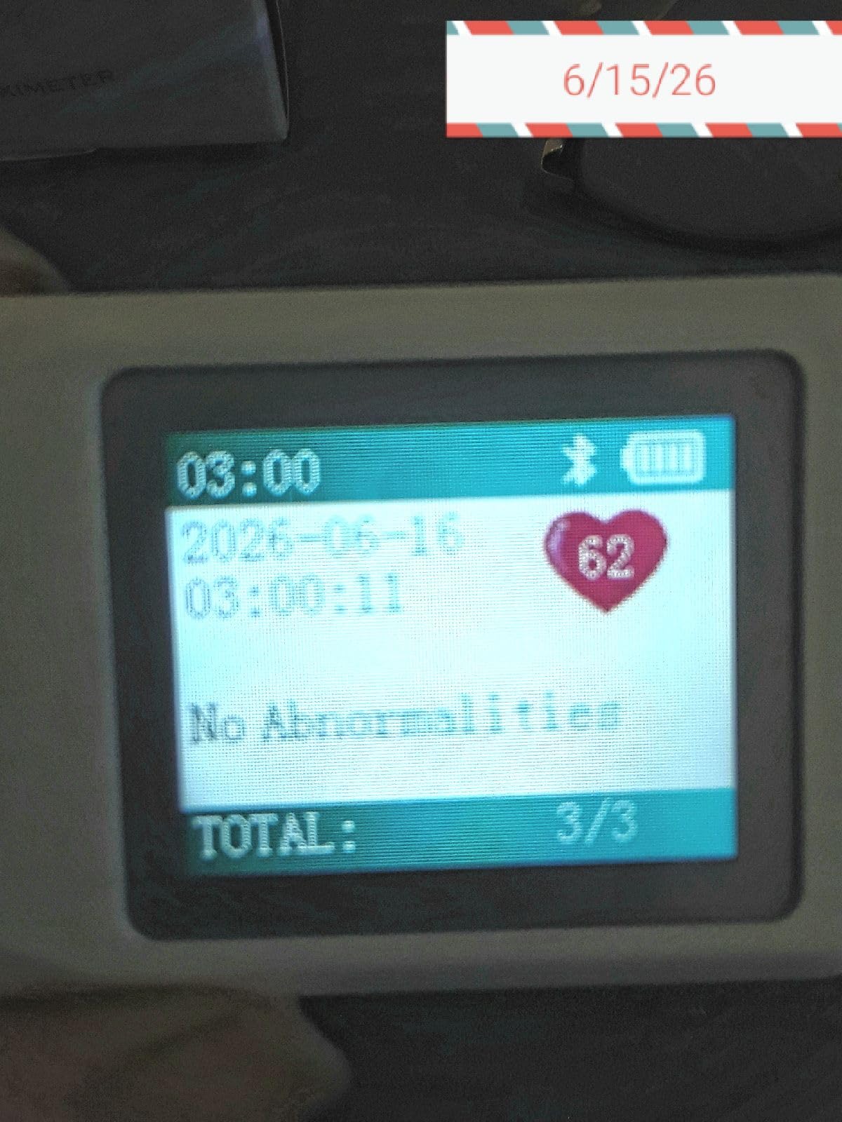 EMAY Portable ECG Monitor | Record ECG and Heart Rate | Compatible with Smartphone and PC customer photo 2