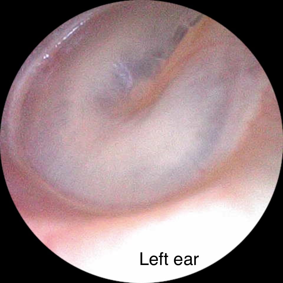Digital Otoscope Compatible with iPhone & Android, Video Ear Scope Camera customer photo 2