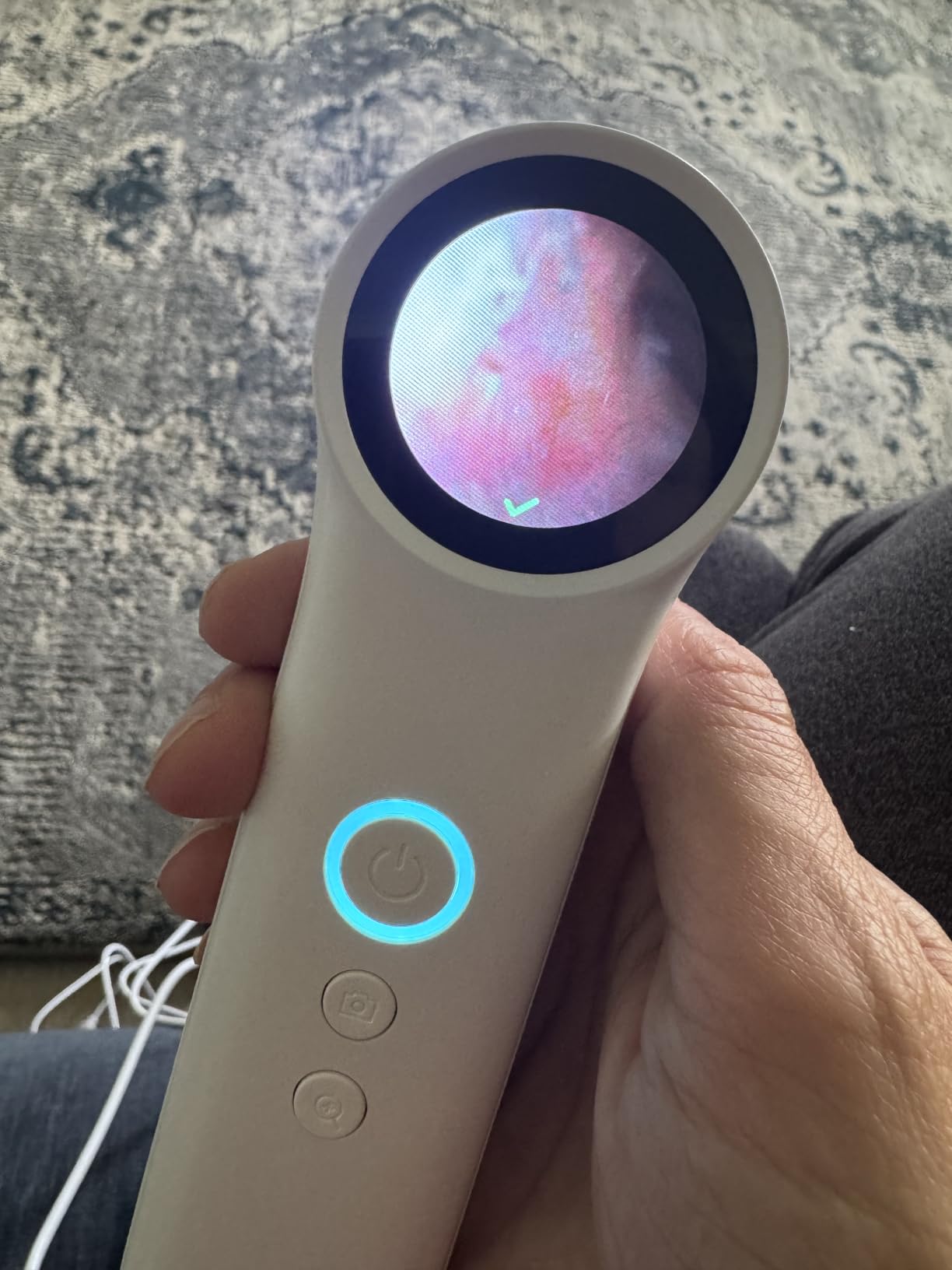 Otoscope with Light, 1080P HD Digital Ear Camera for Adults Kids customer photo 1